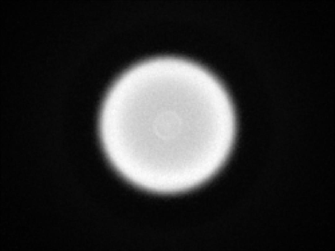 Carclo Optics – 10406 – Samsung_LH151B_spot-image
