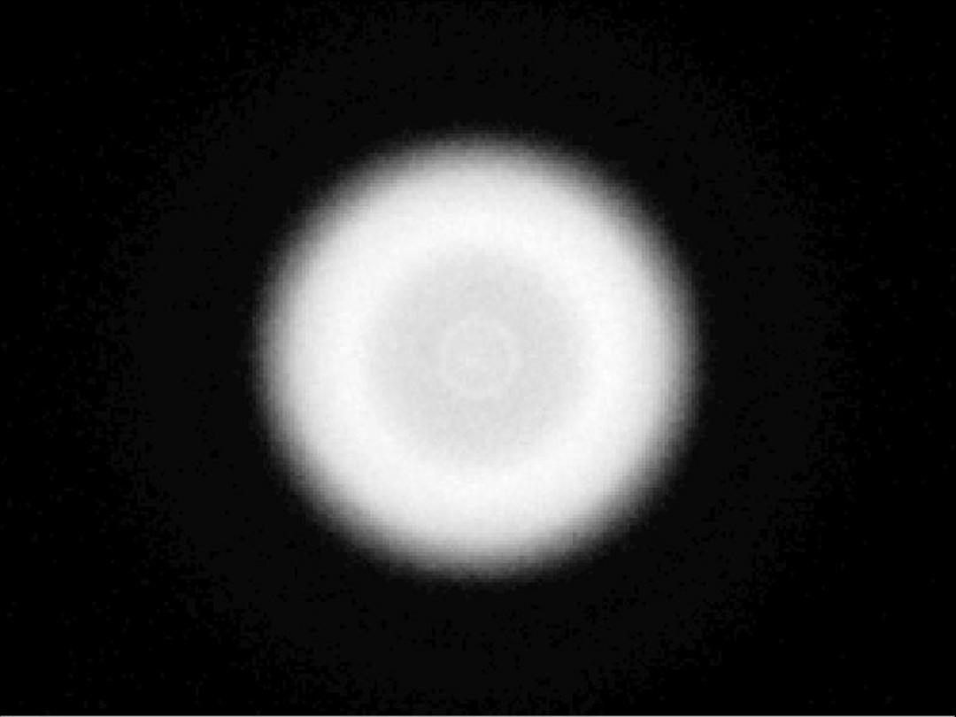 Carclo Optics -10406 Sport Image - Samsung LH181B 4000K