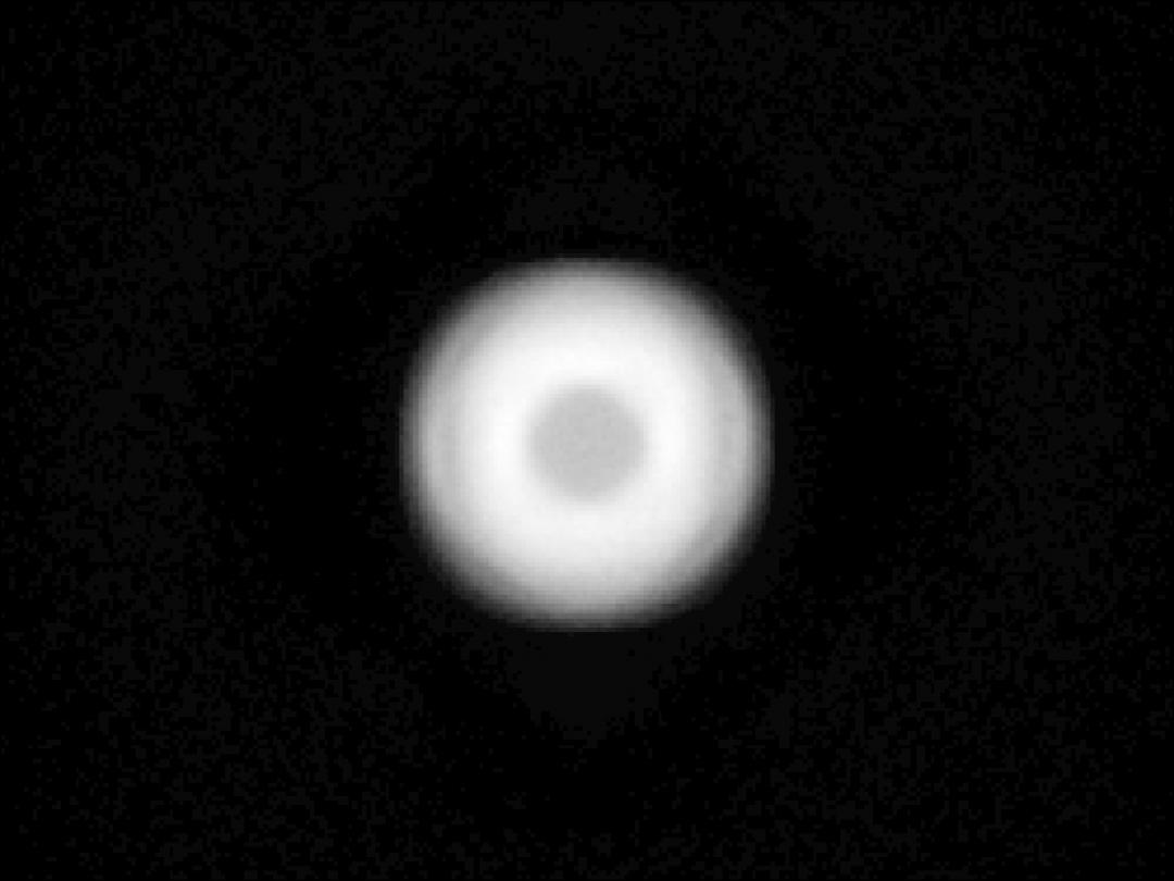Carclo Optics - 10627 Bubble Spot Image Oslon DURIS S8 Gen3